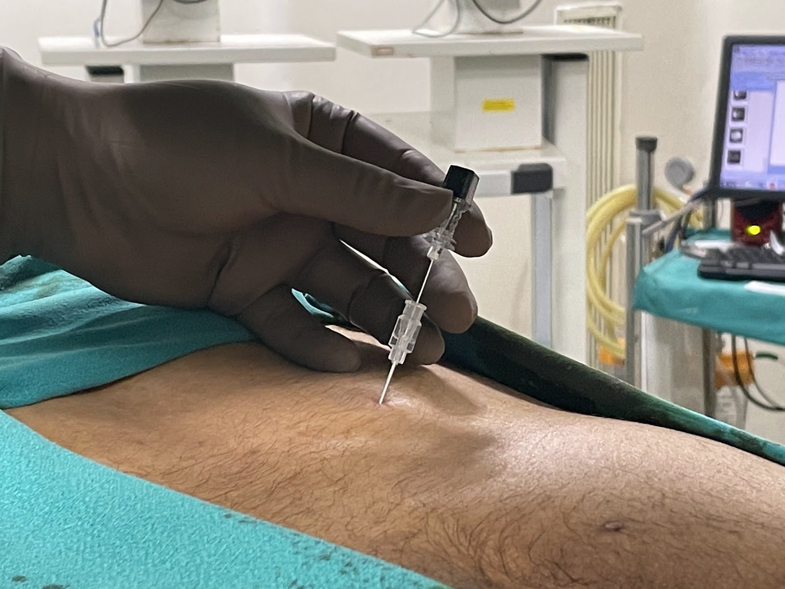 Nerve block injection being administered at Pain Clinic of India