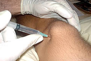 prolotherapy reference image