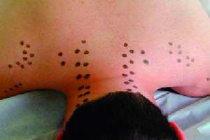 prolotherapy reference image