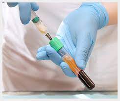 Collecting PRP